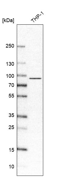 IL-17RA/IL-17R Antibody (CL10283) - Azide and BSA Free Western Blot: IL-17RA/IL-17R Antibody [NBP3-44336]