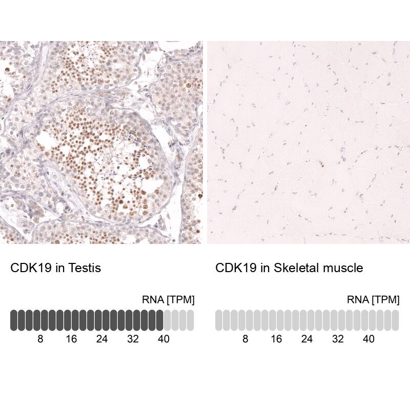 CDC2L6 Antibody (CL14116) - Azide and BSA Free Immunohistochemistry-Paraffin: CDC2L6 Antibody [NBP3-44339]