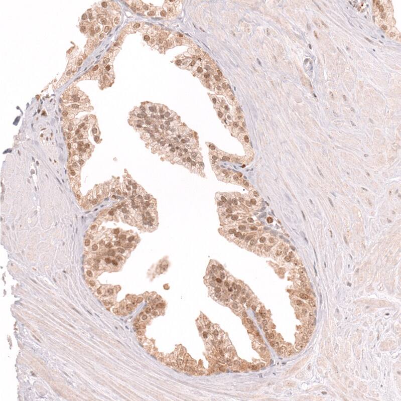 CDC2L6 Antibody (CL14116) - Azide and BSA Free Immunohistochemistry-Paraffin: CDC2L6 Antibody [NBP3-44339]
