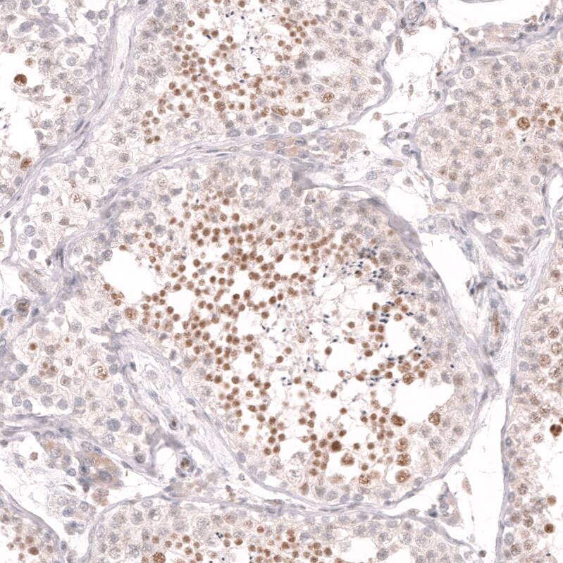 CDC2L6 Antibody (CL14116) - Azide and BSA Free Immunohistochemistry-Paraffin: CDC2L6 Antibody [NBP3-44339]