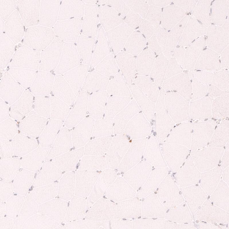 CDC2L6 Antibody (CL14116) - Azide and BSA Free Immunohistochemistry-Paraffin: CDC2L6 Antibody [NBP3-44339]