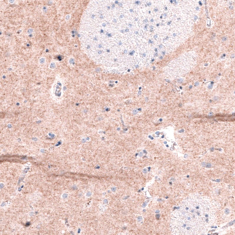 GPR88 Antibody (CL15190) - Azide and BSA Free Immunohistochemistry-Paraffin: GPR88 Antibody [NBP3-44340]