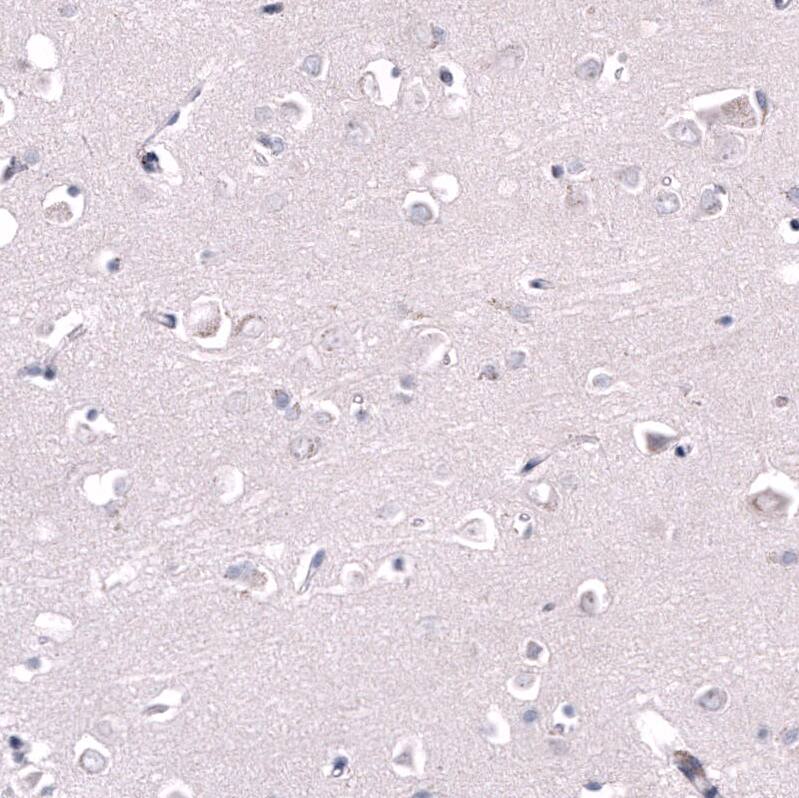GPR88 Antibody (CL15190) - Azide and BSA Free Immunohistochemistry-Paraffin: GPR88 Antibody [NBP3-44340]