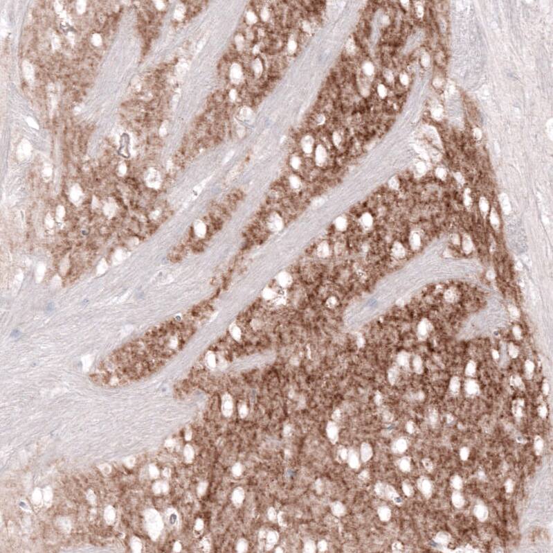 GPR88 Antibody (CL15190) - Azide and BSA Free Immunohistochemistry-Paraffin: GPR88 Antibody [NBP3-44340]