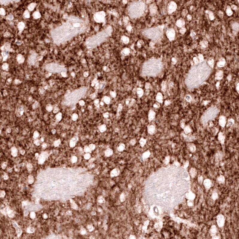 GPR88 Antibody (CL15190) - Azide and BSA Free Immunohistochemistry-Paraffin: GPR88 Antibody [NBP3-44340]