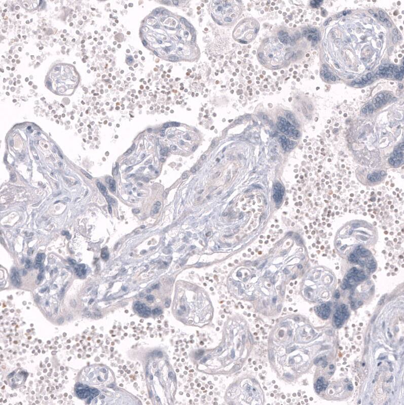 GPR88 Antibody (CL15190) - Azide and BSA Free Immunohistochemistry-Paraffin: GPR88 Antibody [NBP3-44340]