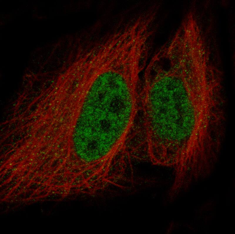 LHX9 Antibody (CL15024) - Azide and BSA Free Immunocytochemistry/ Immunofluorescence: LHX9 Antibody [NBP3-44341]