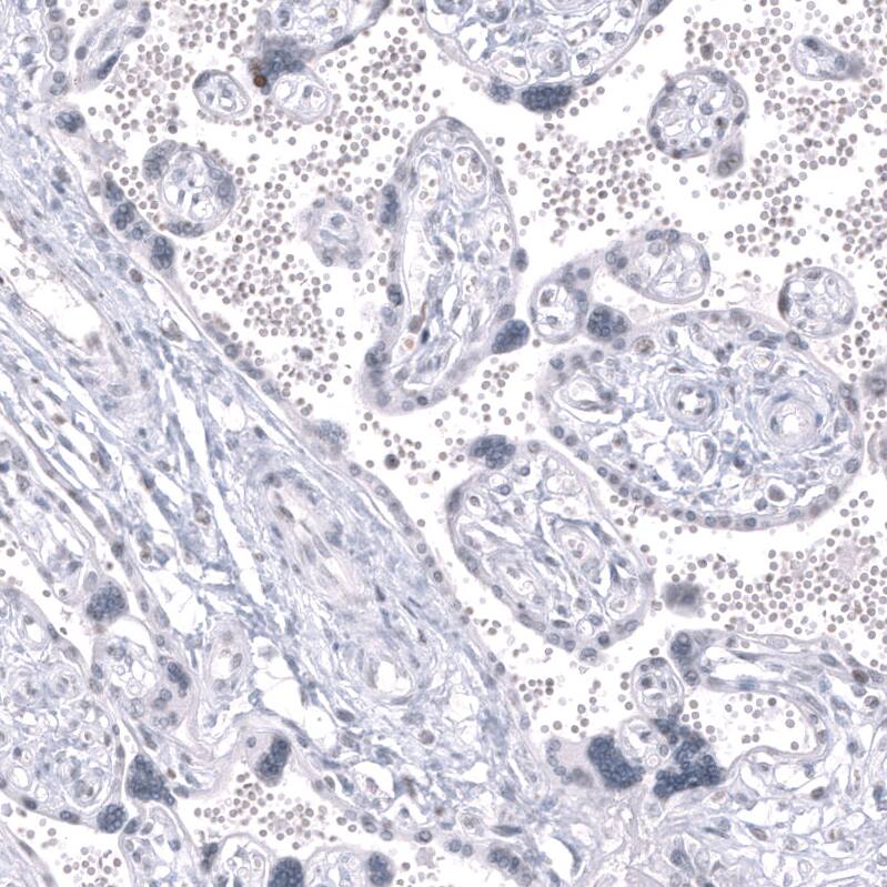 LHX9 Antibody (CL15043) - Azide and BSA Free Immunohistochemistry-Paraffin: LHX9 Antibody [NBP3-44343]