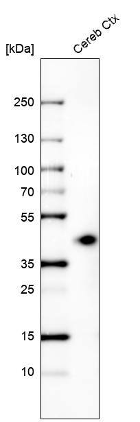 beta-1,3-Glucuronyltransferase 1/B3GAT1 Antibody (CL9499) - Azide and BSA Free Western Blot: beta-1,3-Glucuronyltransferase 1/B3GAT1 Antibody [NBP3-44345]