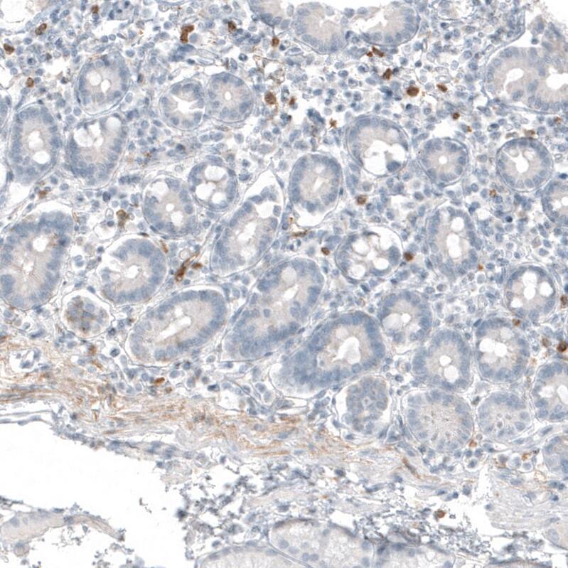 beta-1,3-Glucuronyltransferase 1/B3GAT1 Antibody (CL9500) - Azide and BSA Free Immunohistochemistry-Paraffin: beta-1,3-Glucuronyltransferase 1/B3GAT1 Antibody [NBP3-44346]