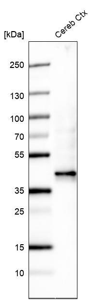beta-1,3-Glucuronyltransferase 1/B3GAT1 Antibody (CL9500) - Azide and BSA Free Western Blot: beta-1,3-Glucuronyltransferase 1/B3GAT1 Antibody [NBP3-44346]