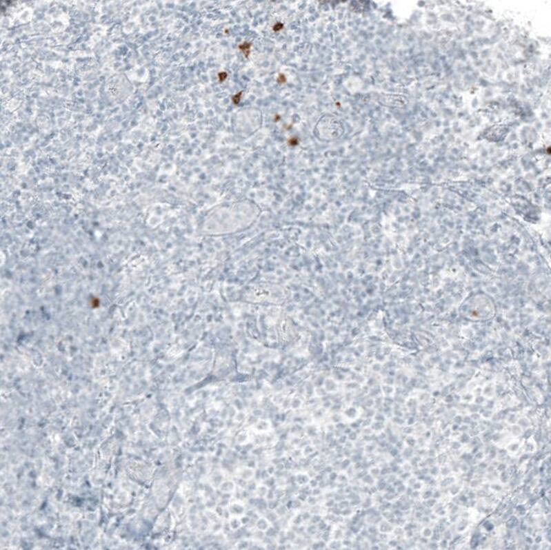 beta-1,3-Glucuronyltransferase 1/B3GAT1 Antibody (CL9500) - Azide and BSA Free Immunohistochemistry-Paraffin: beta-1,3-Glucuronyltransferase 1/B3GAT1 Antibody [NBP3-44346]
