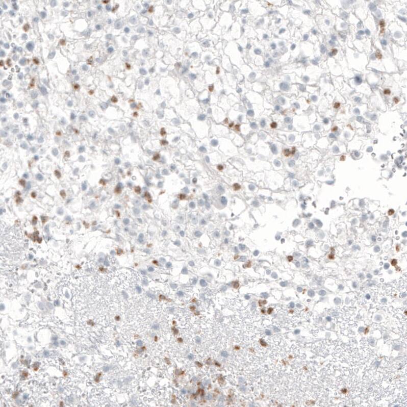 beta-1,3-Glucuronyltransferase 1/B3GAT1 Antibody (CL9500) - Azide and BSA Free Immunohistochemistry-Paraffin: beta-1,3-Glucuronyltransferase 1/B3GAT1 Antibody [NBP3-44346]
