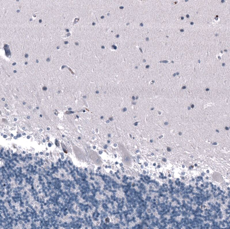 SALL4 Antibody (CL12180) - Azide and BSA Free Immunohistochemistry-Paraffin: SALL4 Antibody [NBP3-44347]