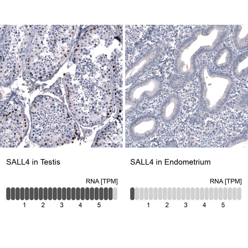 SALL4 Antibody (CL12180) - Azide and BSA Free Immunohistochemistry-Paraffin: SALL4 Antibody [NBP3-44347]