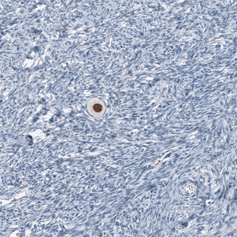 SALL4 Antibody (CL12180) - Azide and BSA Free Immunohistochemistry-Paraffin: SALL4 Antibody [NBP3-44347]