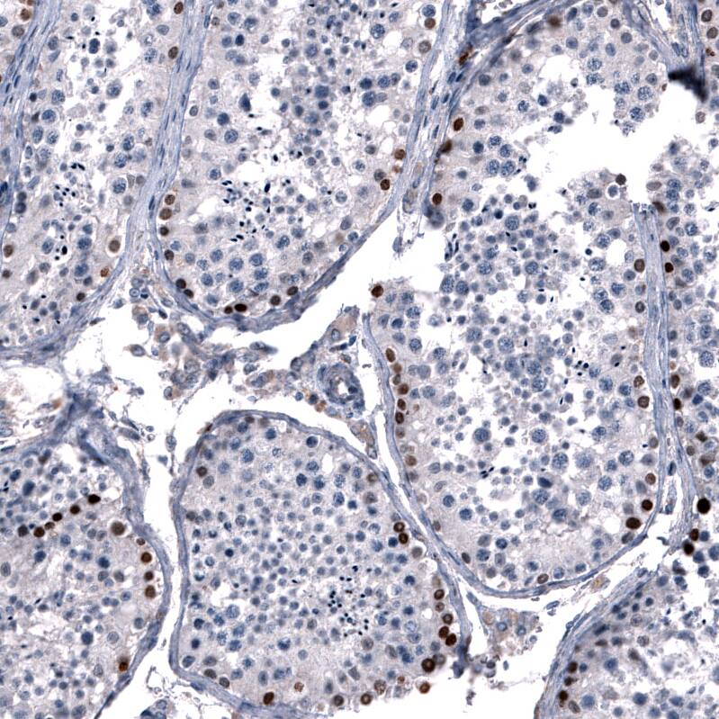 SALL4 Antibody (CL12180) - Azide and BSA Free Immunohistochemistry-Paraffin: SALL4 Antibody [NBP3-44347]