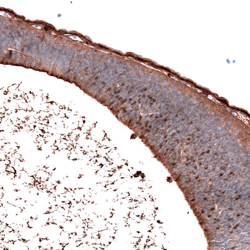 SALL4 Antibody (CL12180) - Azide and BSA Free Immunohistochemistry-Paraffin: SALL4 Antibody [NBP3-44347]