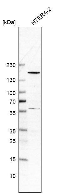 SALL4 Antibody (CL12180) - Azide and BSA Free Western Blot: SALL4 Antibody [NBP3-44347]