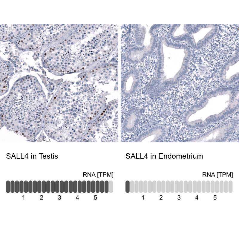SALL4 Antibody (CL12183) - Azide and BSA Free Immunohistochemistry-Paraffin: SALL4 Antibody [NBP3-44348]