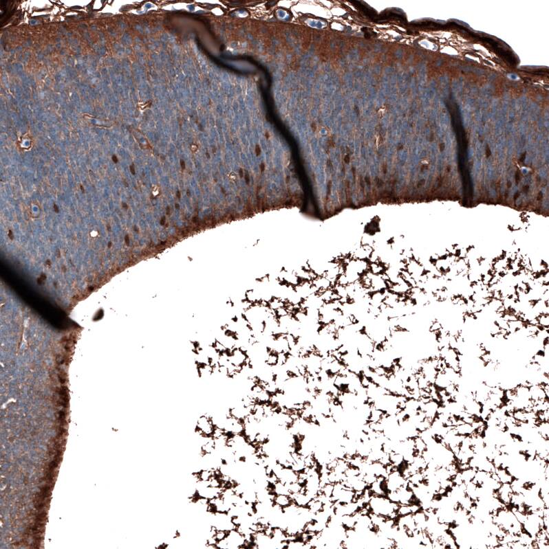 SALL4 Antibody (CL12183) - Azide and BSA Free Immunohistochemistry-Paraffin: SALL4 Antibody [NBP3-44348]