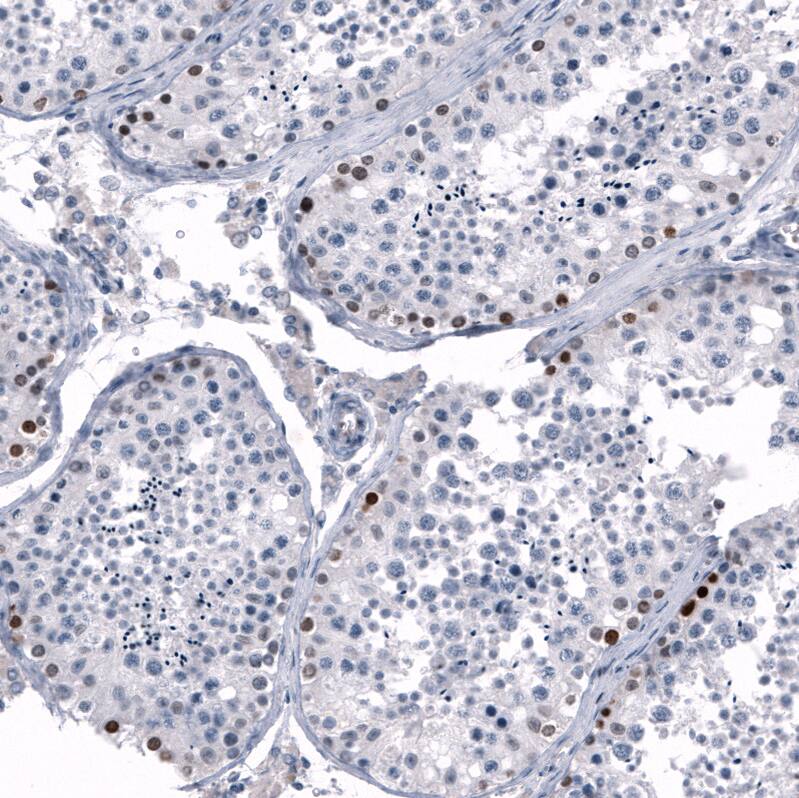 SALL4 Antibody (CL12183) - Azide and BSA Free Immunohistochemistry-Paraffin: SALL4 Antibody [NBP3-44348]