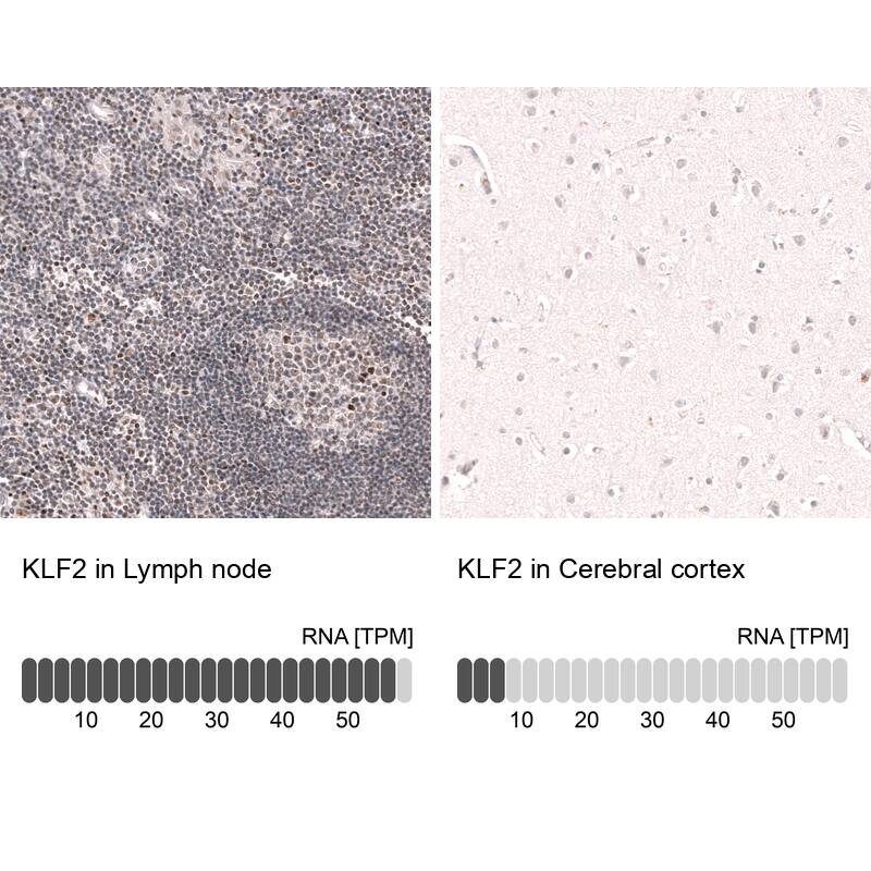 KLF2 Antibody (CL14502) - Azide and BSA Free Immunohistochemistry-Paraffin: KLF2 Antibody [NBP3-44350]