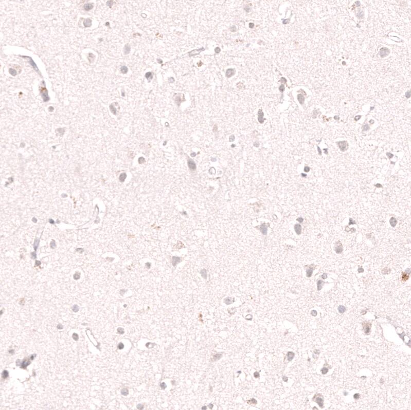 KLF2 Antibody (CL14502) - Azide and BSA Free Immunohistochemistry-Paraffin: KLF2 Antibody [NBP3-44350]