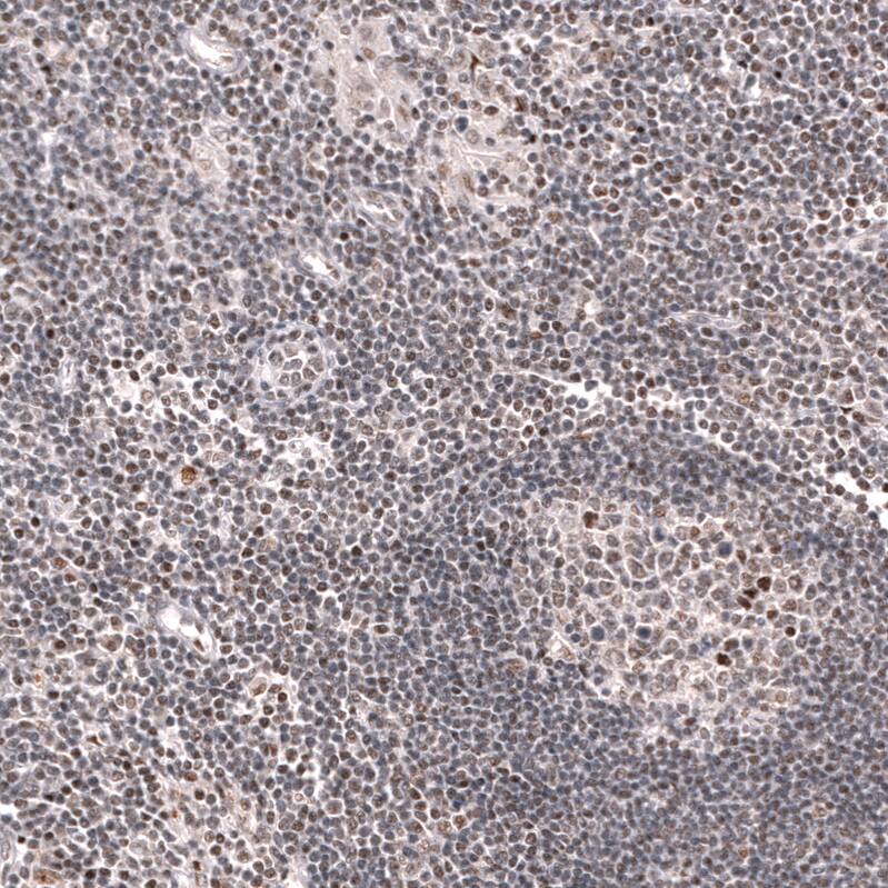 KLF2 Antibody (CL14502) - Azide and BSA Free Immunohistochemistry-Paraffin: KLF2 Antibody [NBP3-44350]