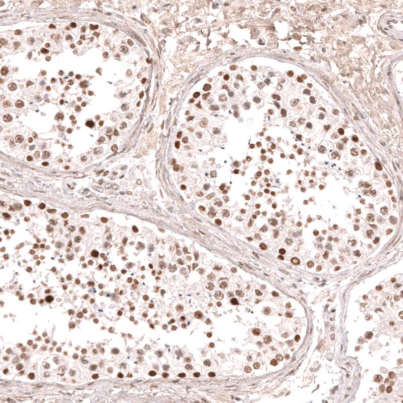 KLF2 Antibody (CL14502) - Azide and BSA Free Immunohistochemistry-Paraffin: KLF2 Antibody [NBP3-44350]