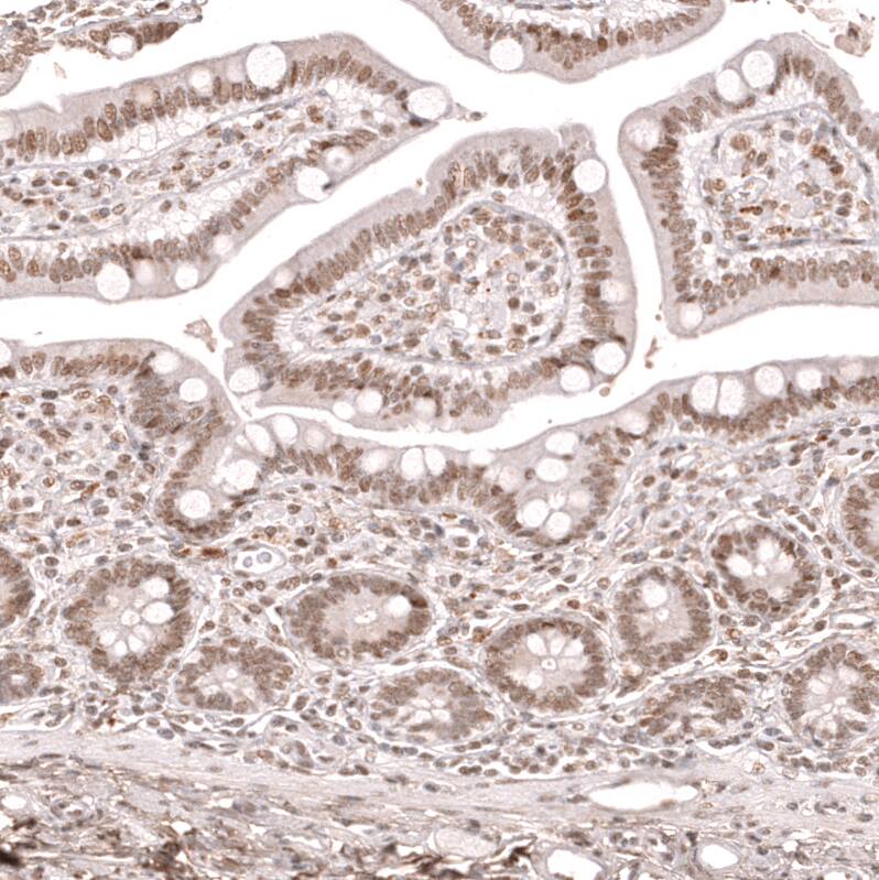 KLF2 Antibody (CL14502) - Azide and BSA Free Immunohistochemistry-Paraffin: KLF2 Antibody [NBP3-44350]