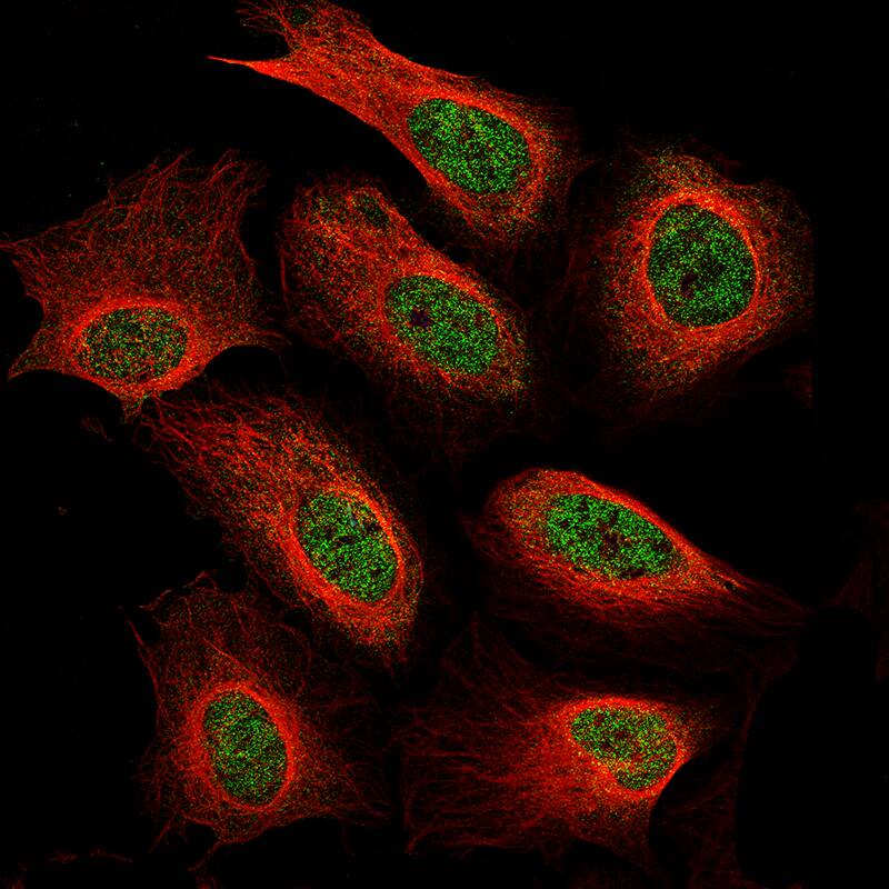 Neurofibromin 1 Antibody (CL11865) - Azide and BSA Free Immunocytochemistry/ Immunofluorescence: Neurofibromin 1 Antibody [NBP3-44353]