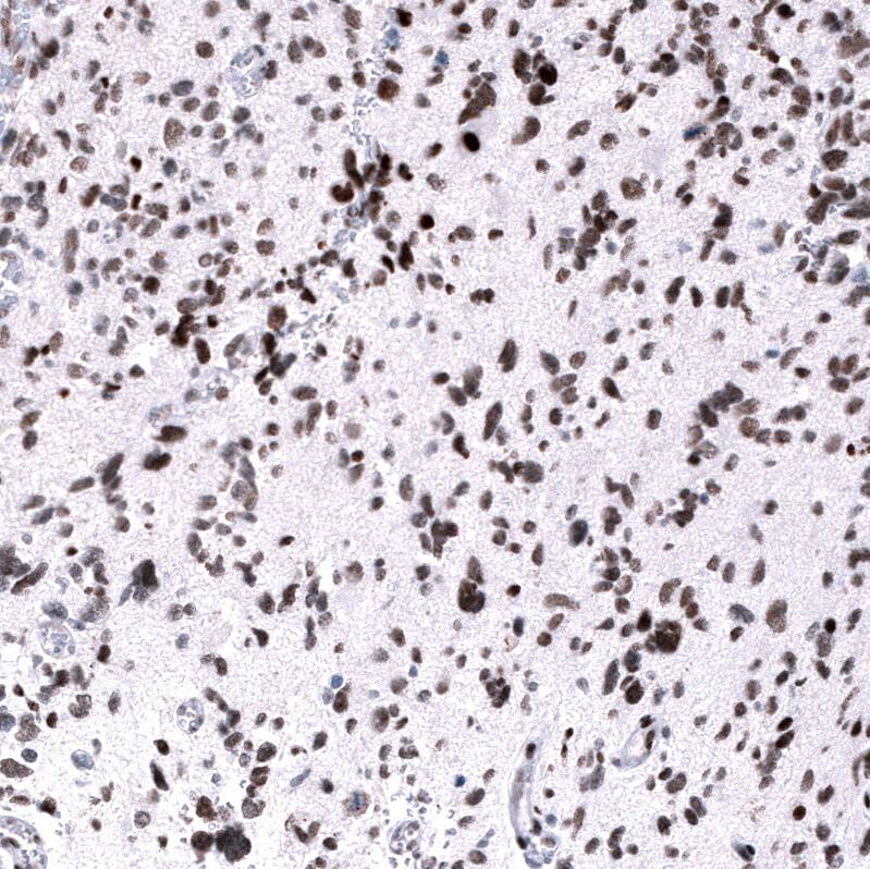 EZH2/KMT6 Antibody (CL11960) - Azide and BSA Free Immunohistochemistry-Paraffin: EZH2/KMT6 Antibody [NBP3-44355]