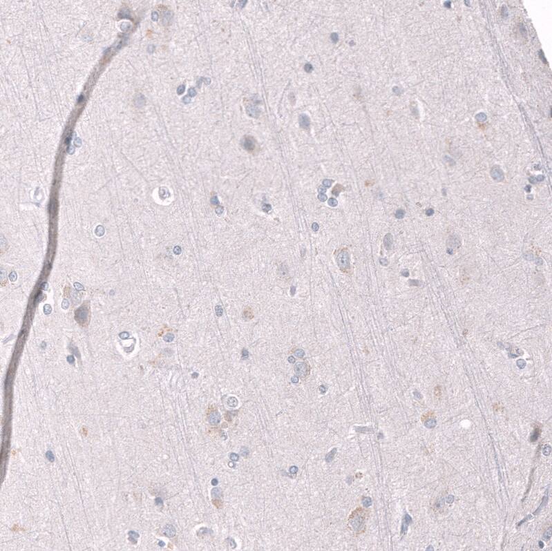 EZH2/KMT6 Antibody (CL11960) - Azide and BSA Free Immunohistochemistry-Paraffin: EZH2/KMT6 Antibody [NBP3-44355]