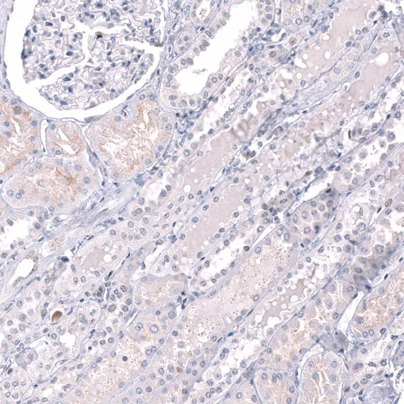 EZH2/KMT6 Antibody (CL11960) - Azide and BSA Free Immunohistochemistry-Paraffin: EZH2/KMT6 Antibody [NBP3-44355]