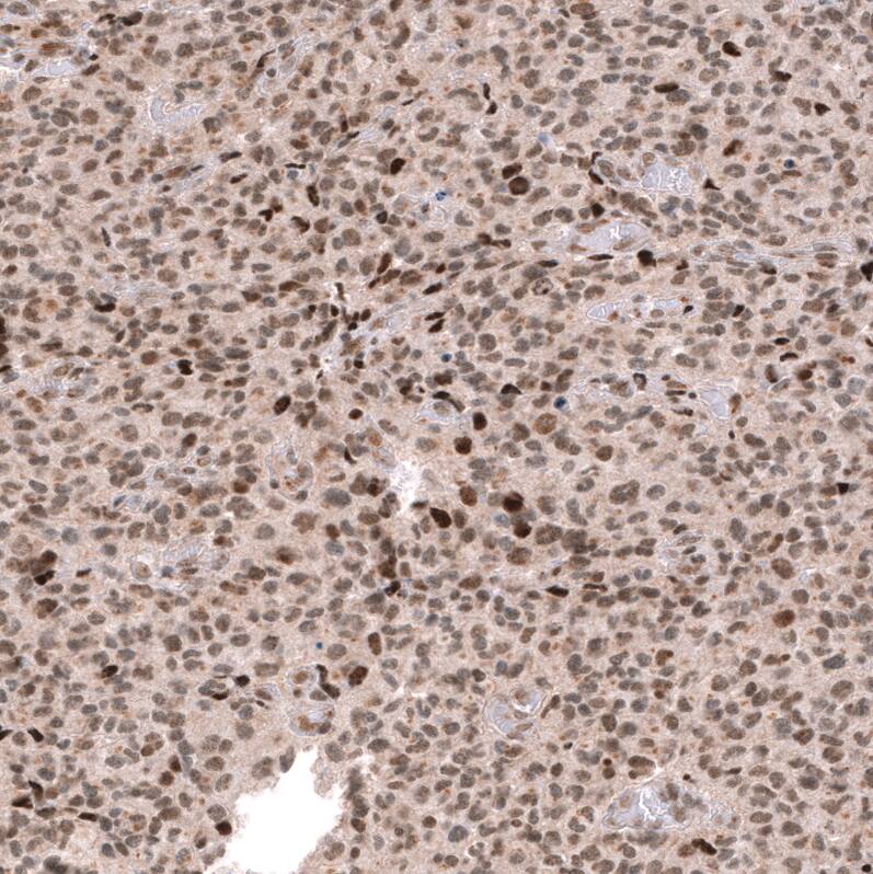 EZH2/KMT6 Antibody (CL11960) - Azide and BSA Free Immunohistochemistry-Paraffin: EZH2/KMT6 Antibody [NBP3-44355]