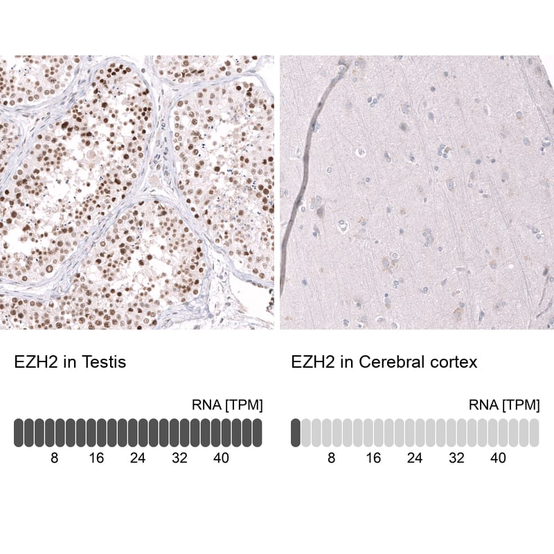 EZH2/KMT6 Antibody (CL11960) - Azide and BSA Free Immunohistochemistry-Paraffin: EZH2/KMT6 Antibody [NBP3-44355]