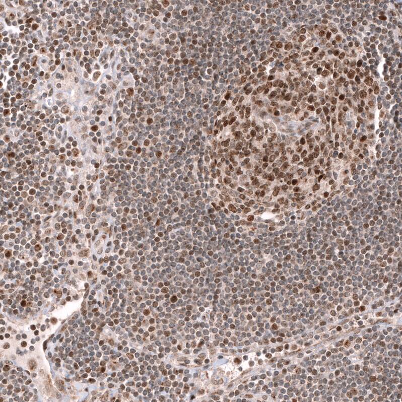 EZH2/KMT6 Antibody (CL11960) - Azide and BSA Free Immunohistochemistry-Paraffin: EZH2/KMT6 Antibody [NBP3-44355]