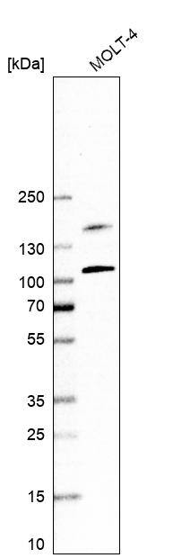 EZH2/KMT6 Antibody (CL11960) - Azide and BSA Free Western Blot: EZH2/KMT6 Antibody [NBP3-44355]