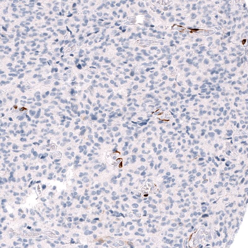 ALDH1A3 Antibody (CL11968) - Azide and BSA Free Immunohistochemistry-Paraffin: ALDH1A3 Antibody [NBP3-44356]