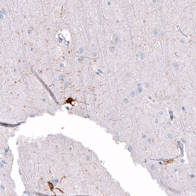 ALDH1A3 Antibody (CL11968) - Azide and BSA Free Immunohistochemistry-Paraffin: ALDH1A3 Antibody [NBP3-44356]
