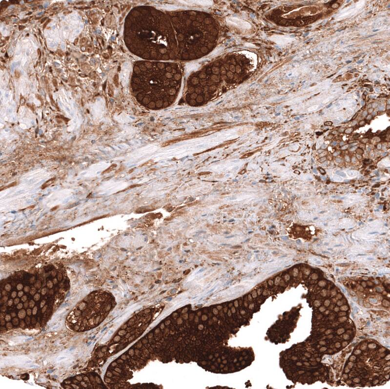 ALDH1A3 Antibody (CL11968) - Azide and BSA Free Immunohistochemistry-Paraffin: ALDH1A3 Antibody [NBP3-44356]