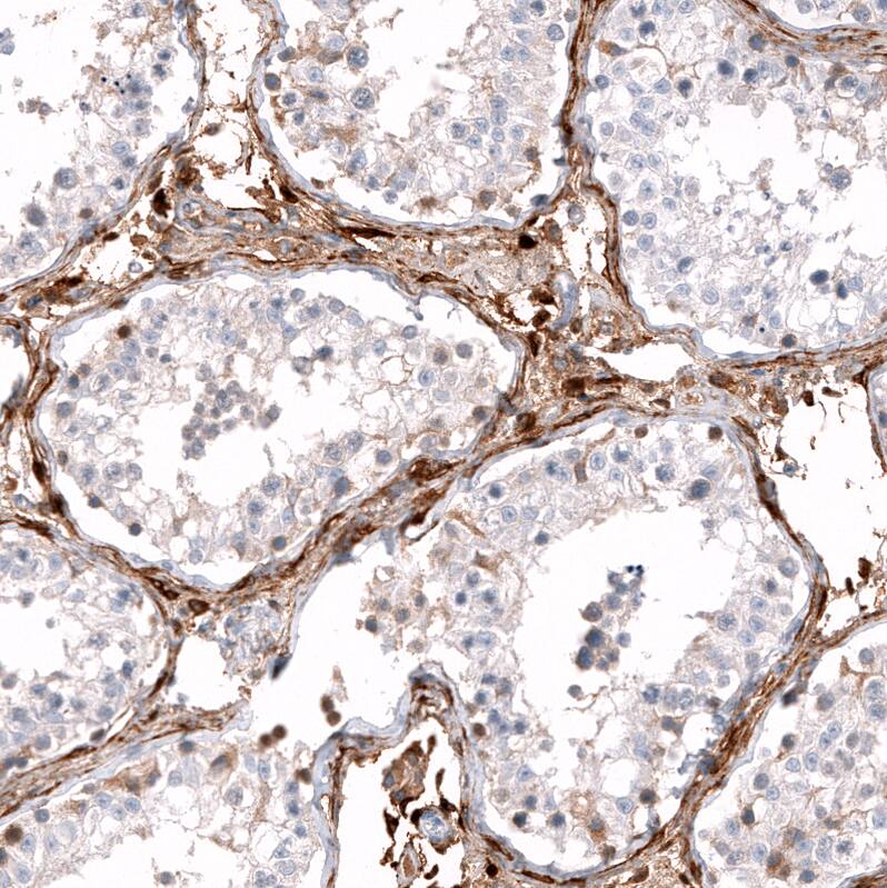 ALDH1A3 Antibody (CL11968) - Azide and BSA Free Immunohistochemistry-Paraffin: ALDH1A3 Antibody [NBP3-44356]