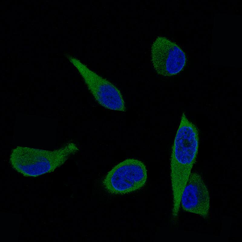 ALDH1A3 Antibody (CL11968) - Azide and BSA Free Immunocytochemistry/ Immunofluorescence: ALDH1A3 Antibody [NBP3-44356]