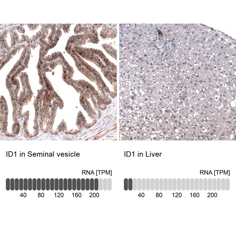 ID1 Antibody (CL11995) - Azide and BSA Free Immunohistochemistry-Paraffin: ID1 Antibody [NBP3-44357]