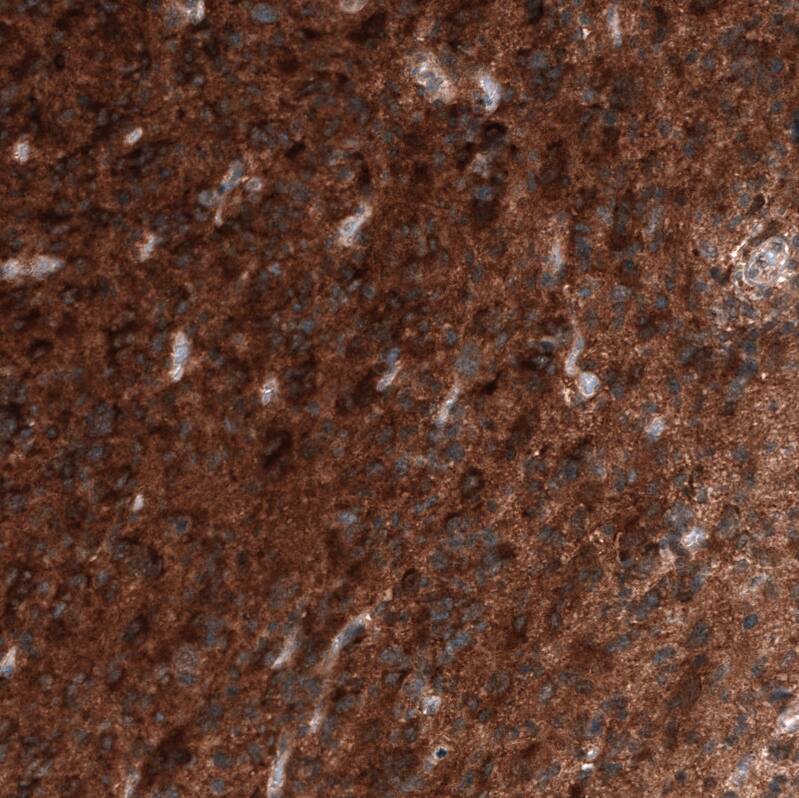 ID1 Antibody (CL11995) - Azide and BSA Free Immunohistochemistry-Paraffin: ID1 Antibody [NBP3-44357]