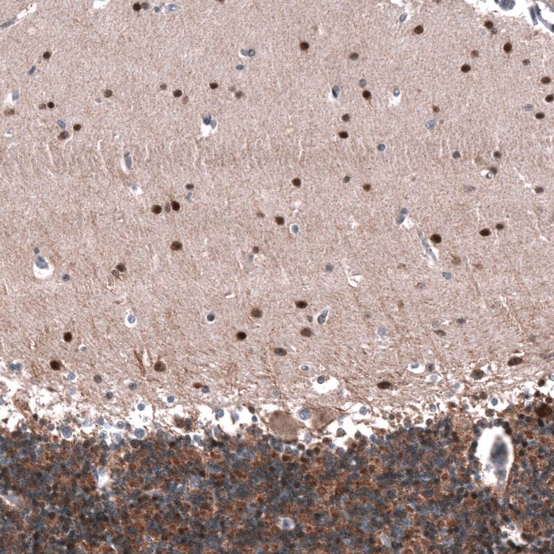 ID1 Antibody (CL11995) - Azide and BSA Free Immunohistochemistry-Paraffin: ID1 Antibody [NBP3-44357]