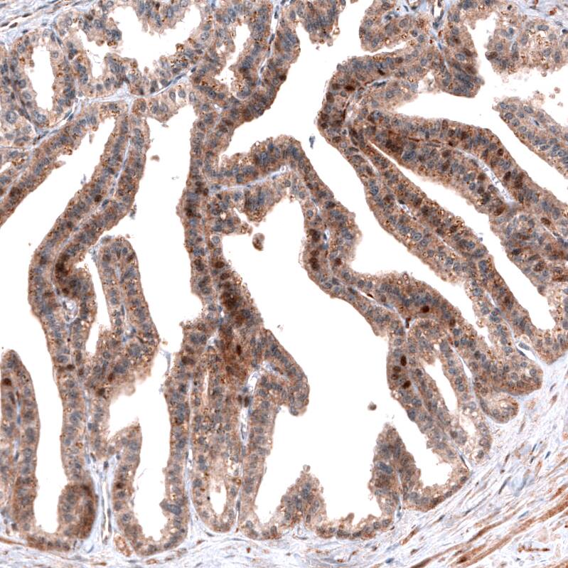 ID1 Antibody (CL11995) - Azide and BSA Free Immunohistochemistry-Paraffin: ID1 Antibody [NBP3-44357]