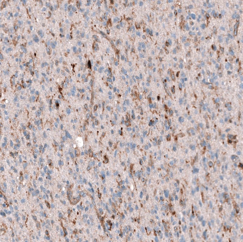 Periostin/OSF-2 Antibody (CL12087) - Azide and BSA Free Immunohistochemistry-Paraffin: Periostin/OSF-2 Antibody [NBP3-44358]