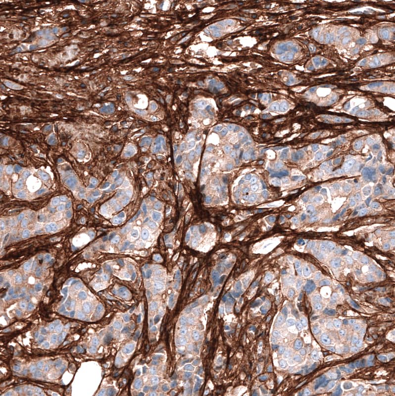 Periostin/OSF-2 Antibody (CL12087) - Azide and BSA Free Immunohistochemistry-Paraffin: Periostin/OSF-2 Antibody [NBP3-44358]